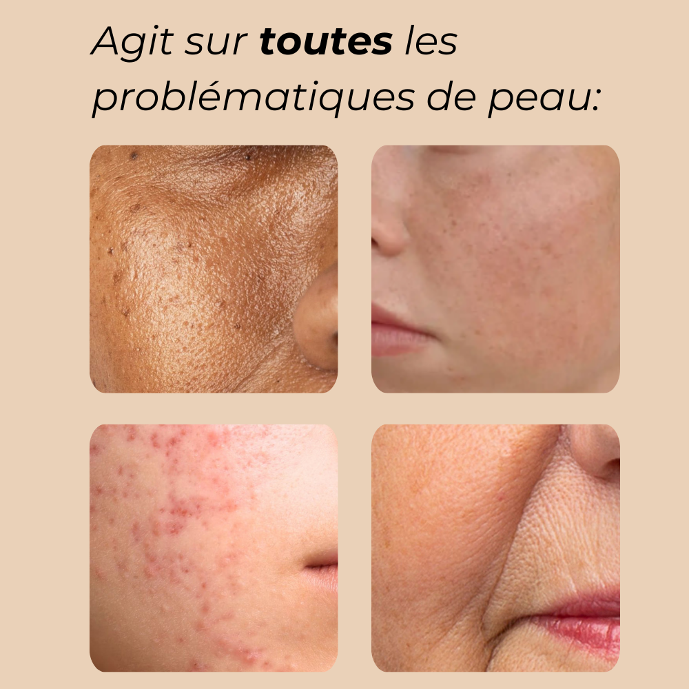 Masque facial de luminothérapie 2.0