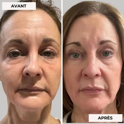 Masque facial de luminothérapie 2.0