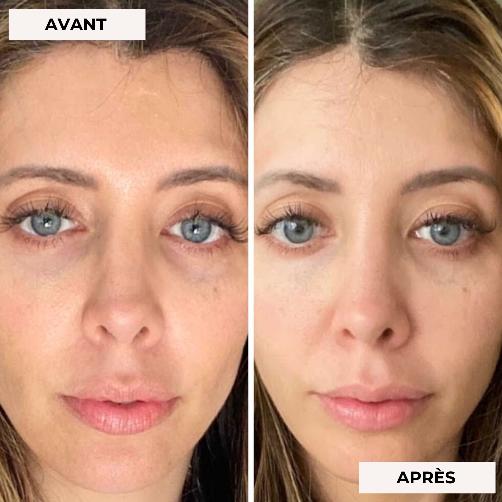 Masque facial de luminothérapie 2.0