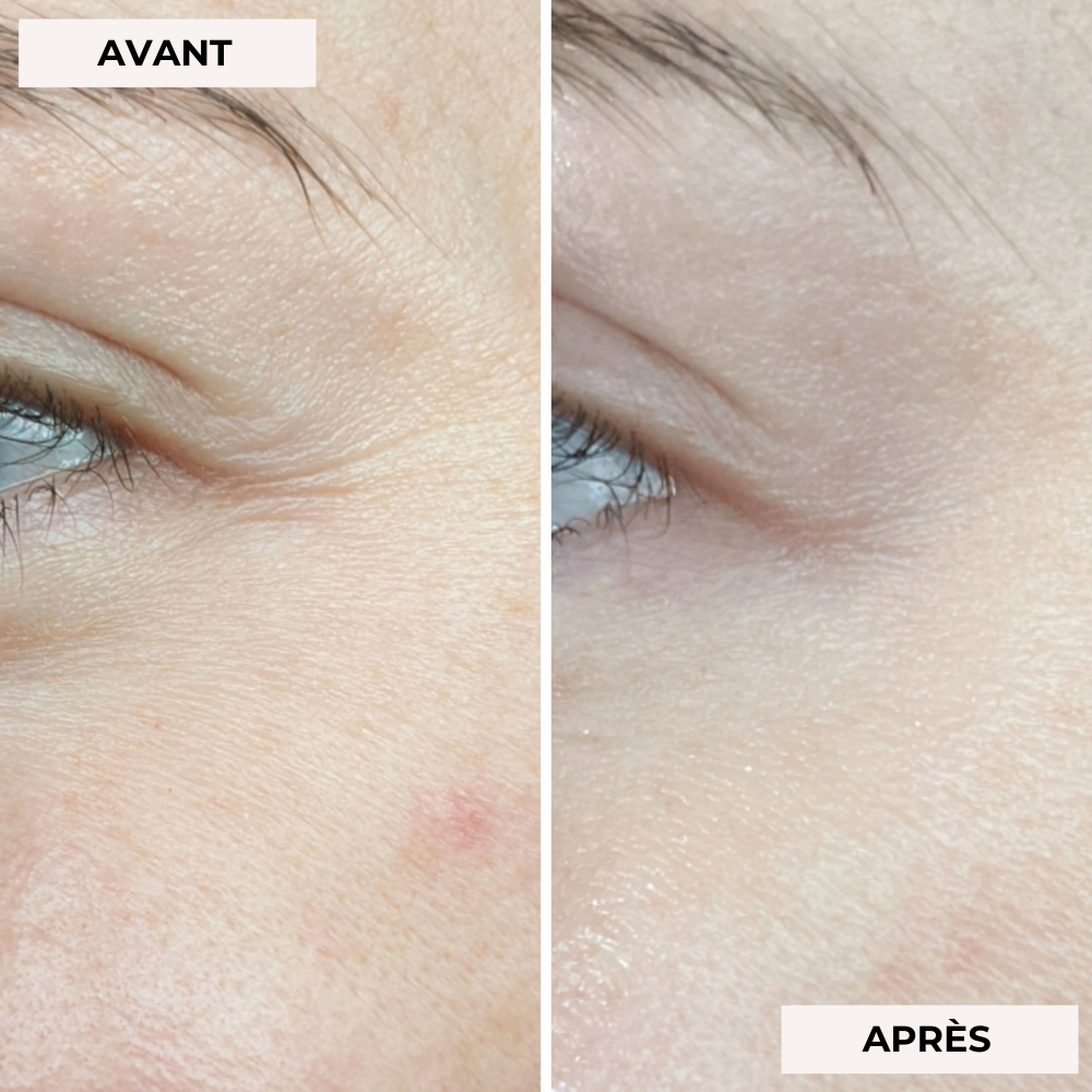 Masque facial de luminothérapie 2.0