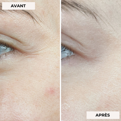 Masque facial de luminothérapie 2.0