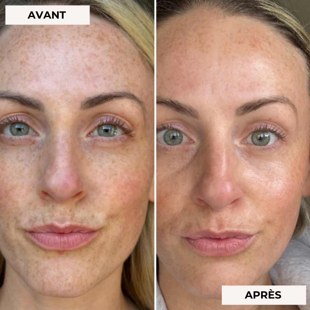 Masque facial de luminothérapie 2.0